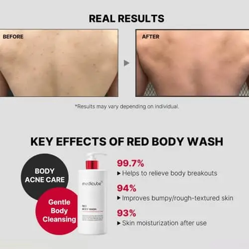 ⁦Medicube - Red Acne Body Wash 400g <br/> غسول الجسم لعلاج حب الشباب⁩ - الصورة ⁦2⁩