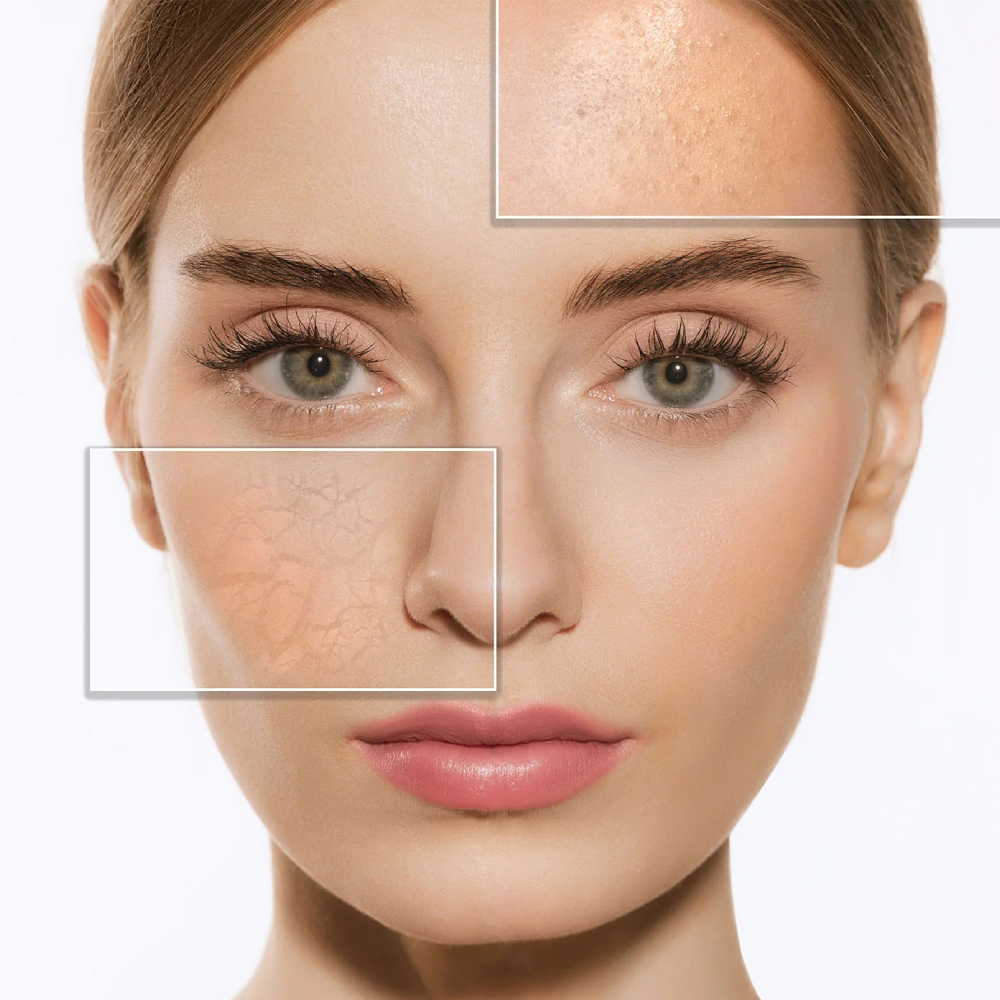 البشرة المختلطة