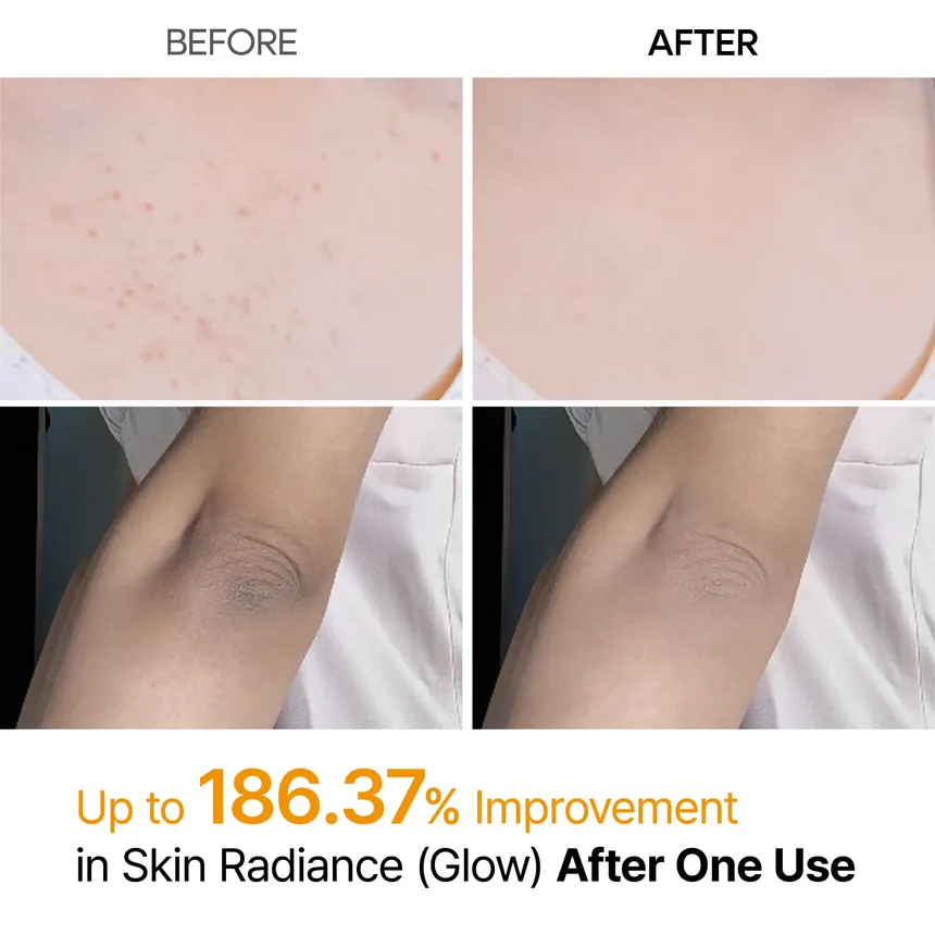 Dr Melaxin - Peel Shot Exfoliating Kojic Acid Turmeric Spray 200ml Prix Algérie