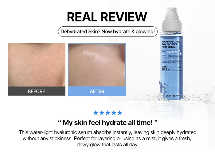 Meditherapy - Hyaluronic Acid Skin Booster First Serum 150ml Prix Algére KBPstore